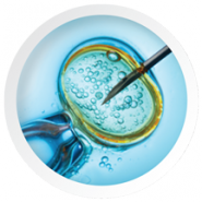 ivf_procedure_showing_needle_injection3in ivf_procedure_showing_needle_injection3in