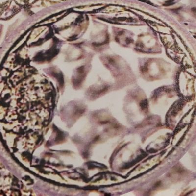 Blastocyst embryo in the IVF laboratory